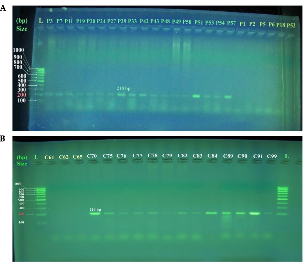 HLA-B*0702 class-I allele, anti-FSH, anti-LH, and vitamin D3: Potential links with polycystic ovary syndrome in women of Erbil city, Iraq