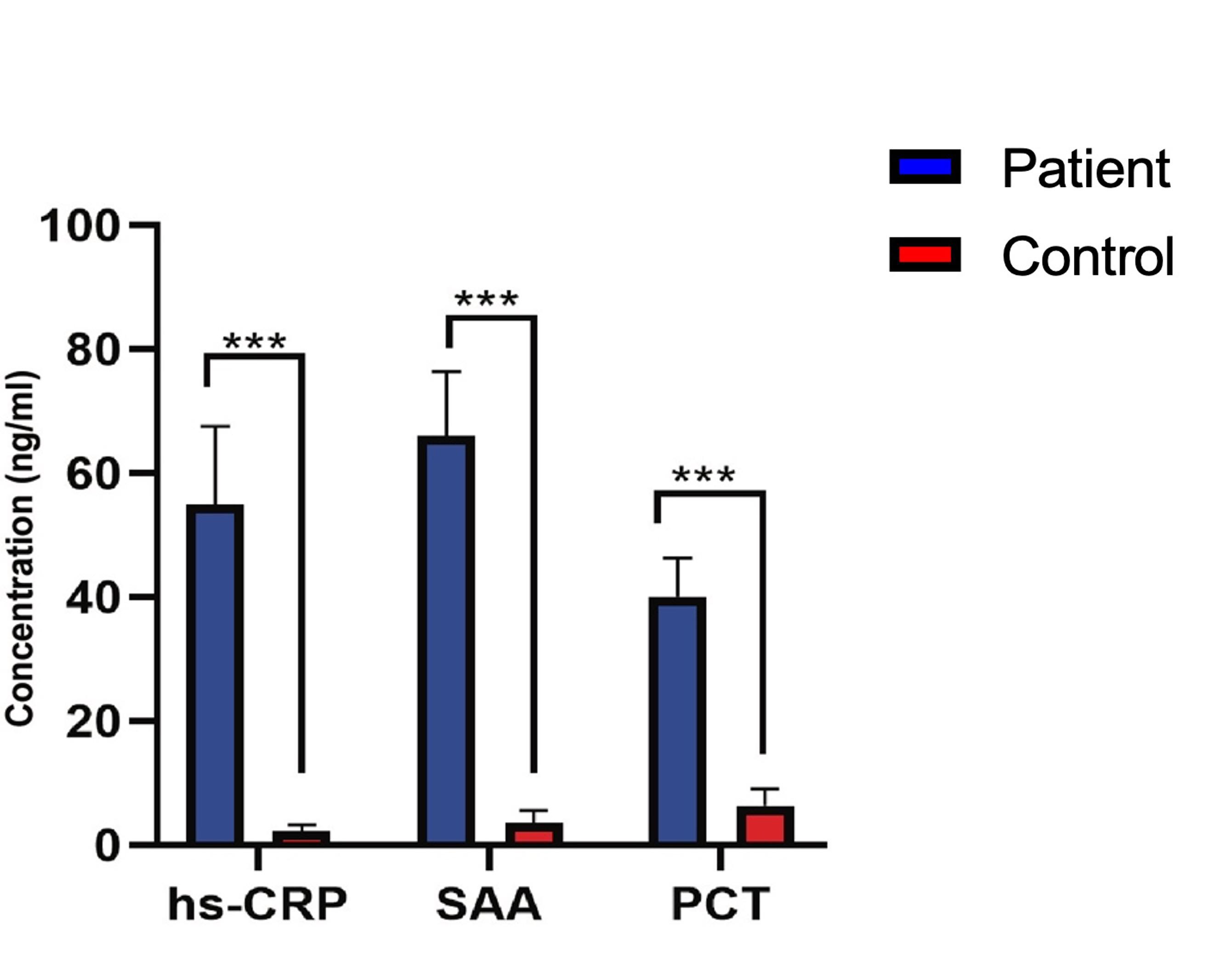 Exploring the role of autoantibodies in Iraqi females with polycystic ovary syndrome