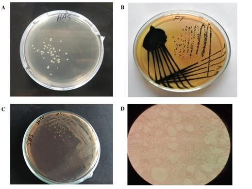 Phenotypic screening of extended-spectrum beta-lactamase producing Salmonella in retail shrimp