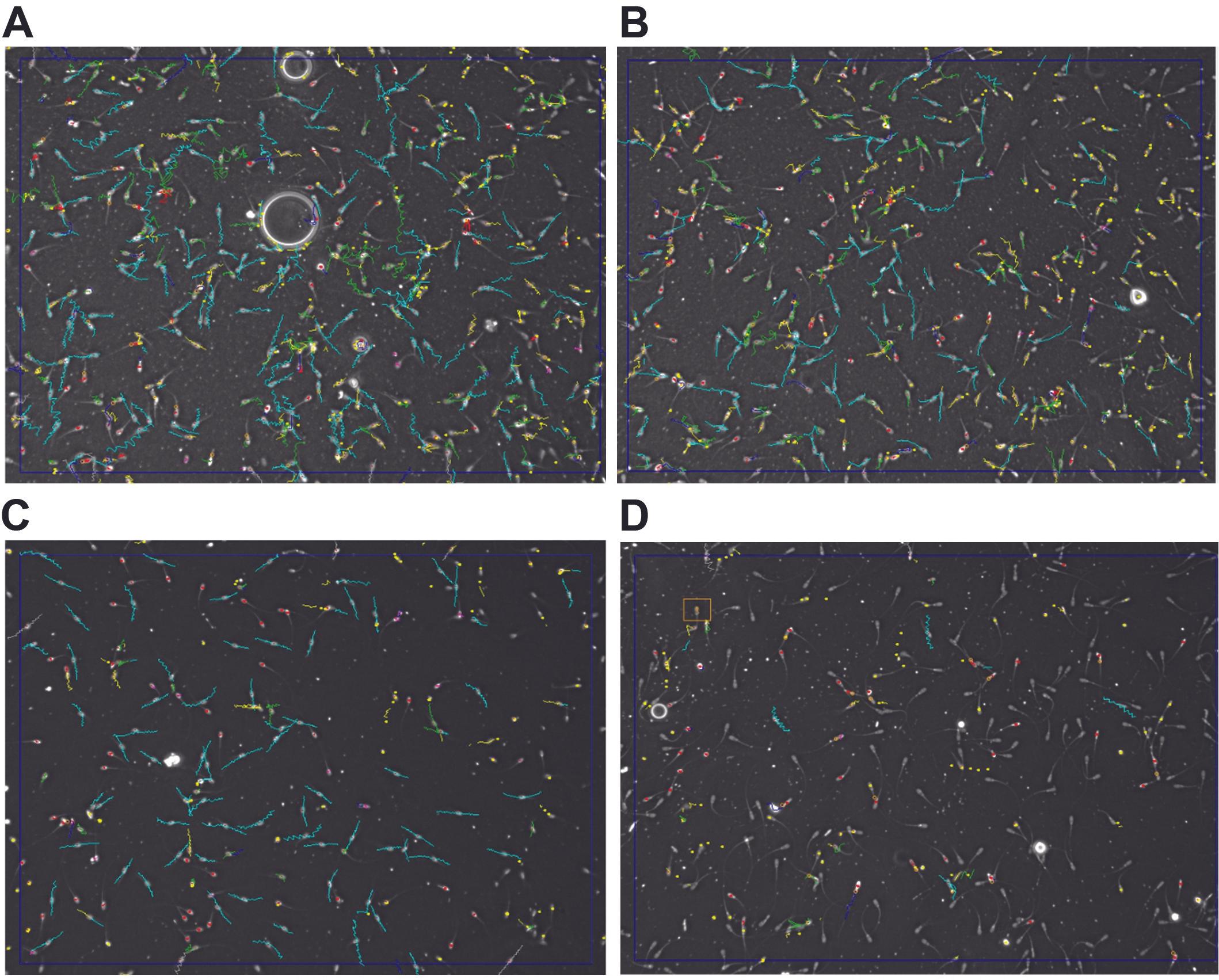 Assessing the efficacy of different semen extenders on post-thaw quality of Bangladeshi buffalo sperm under a manual cryopreservation protocol