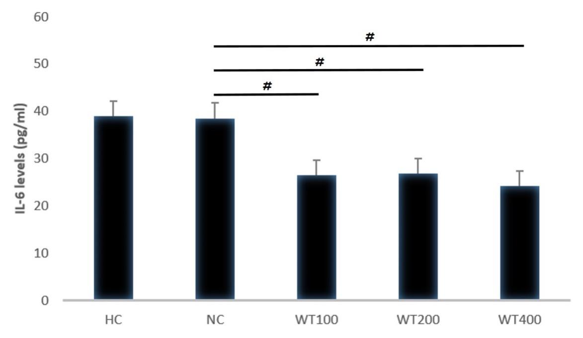 Effect of white tea (Camellia sinensis) leaf extract on cigarette smoke and high-fat diet-induced atherosclerosis in Wistar rats