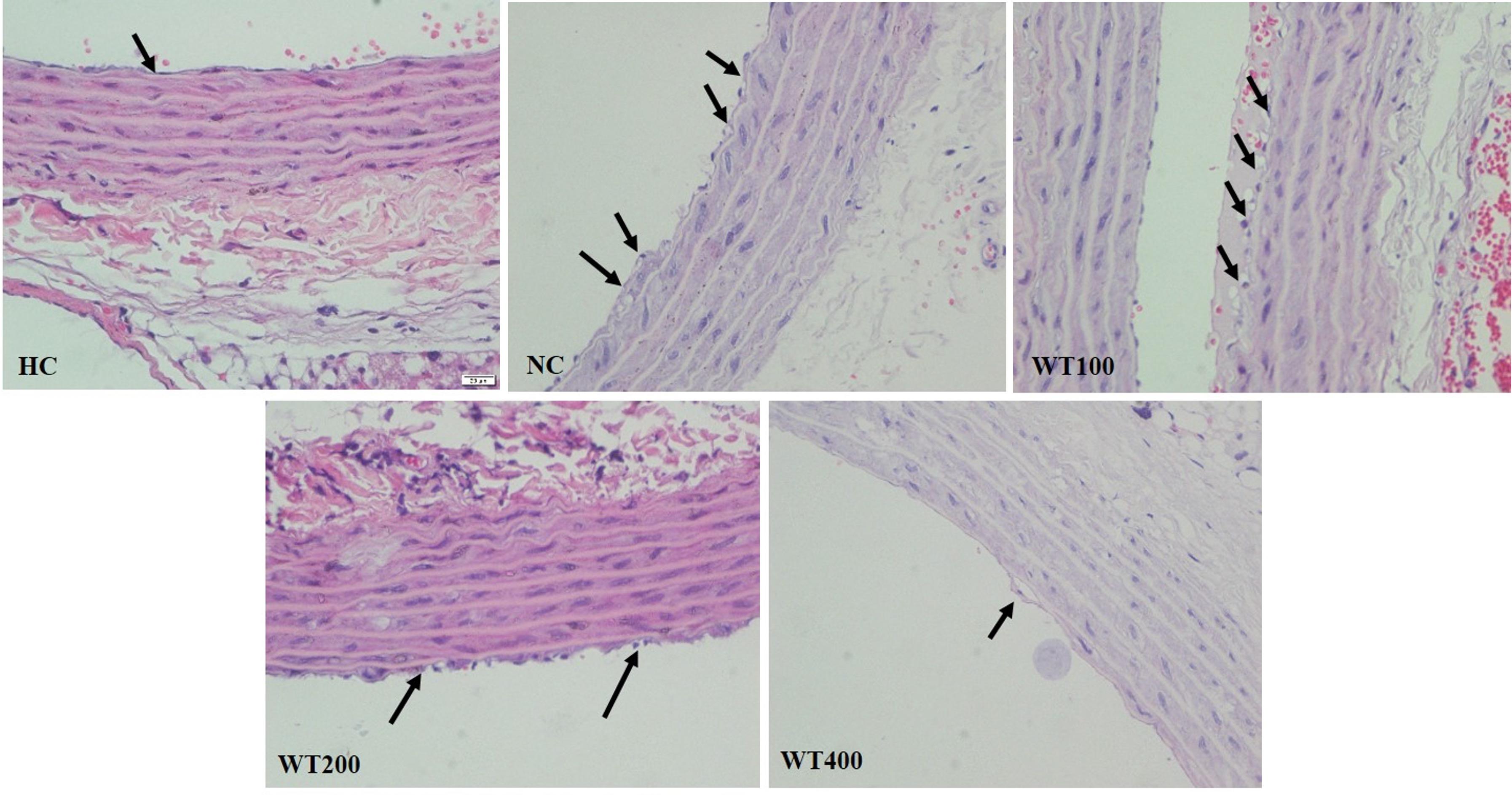 Effect of white tea (Camellia sinensis) leaf extract on cigarette smoke and high-fat diet-induced atherosclerosis in Wistar rats