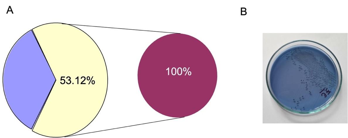 Evaluation of selective mitis salivarius agar for the isolation of Streptococcus mutans and its resistance pattern in Bangladesh