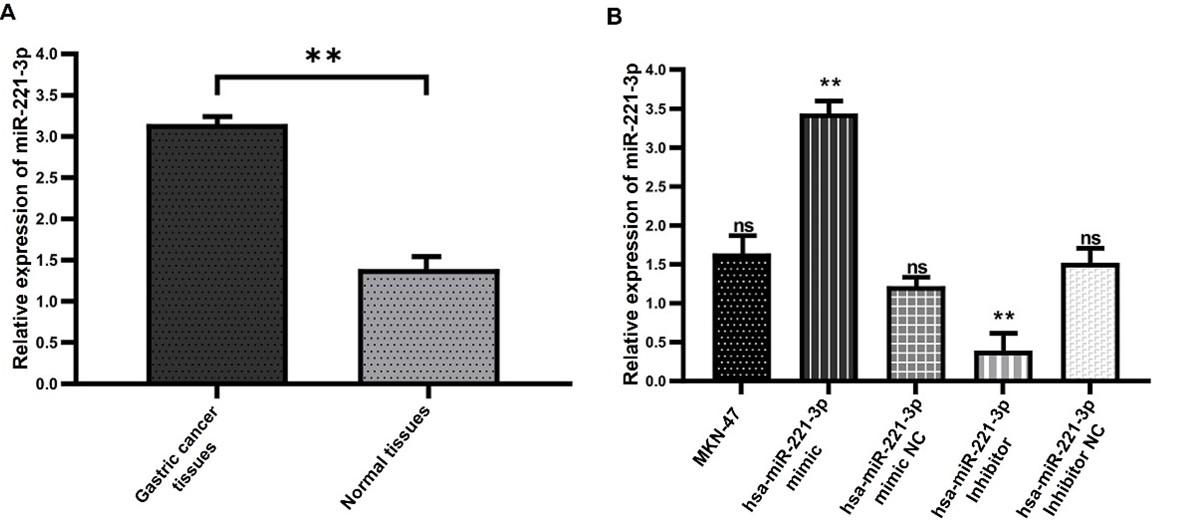 MicroRNA-221-3p promotes cell proliferation, migration, and invasion in gastric cancer by modulating PIK3R1