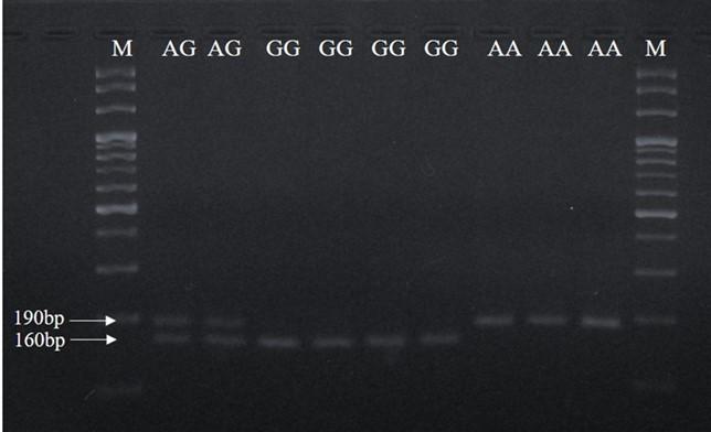 Validation study of c.746A>G SNP of BMPR1B gene associated with litter size in sheep genetic resources of Bangladesh