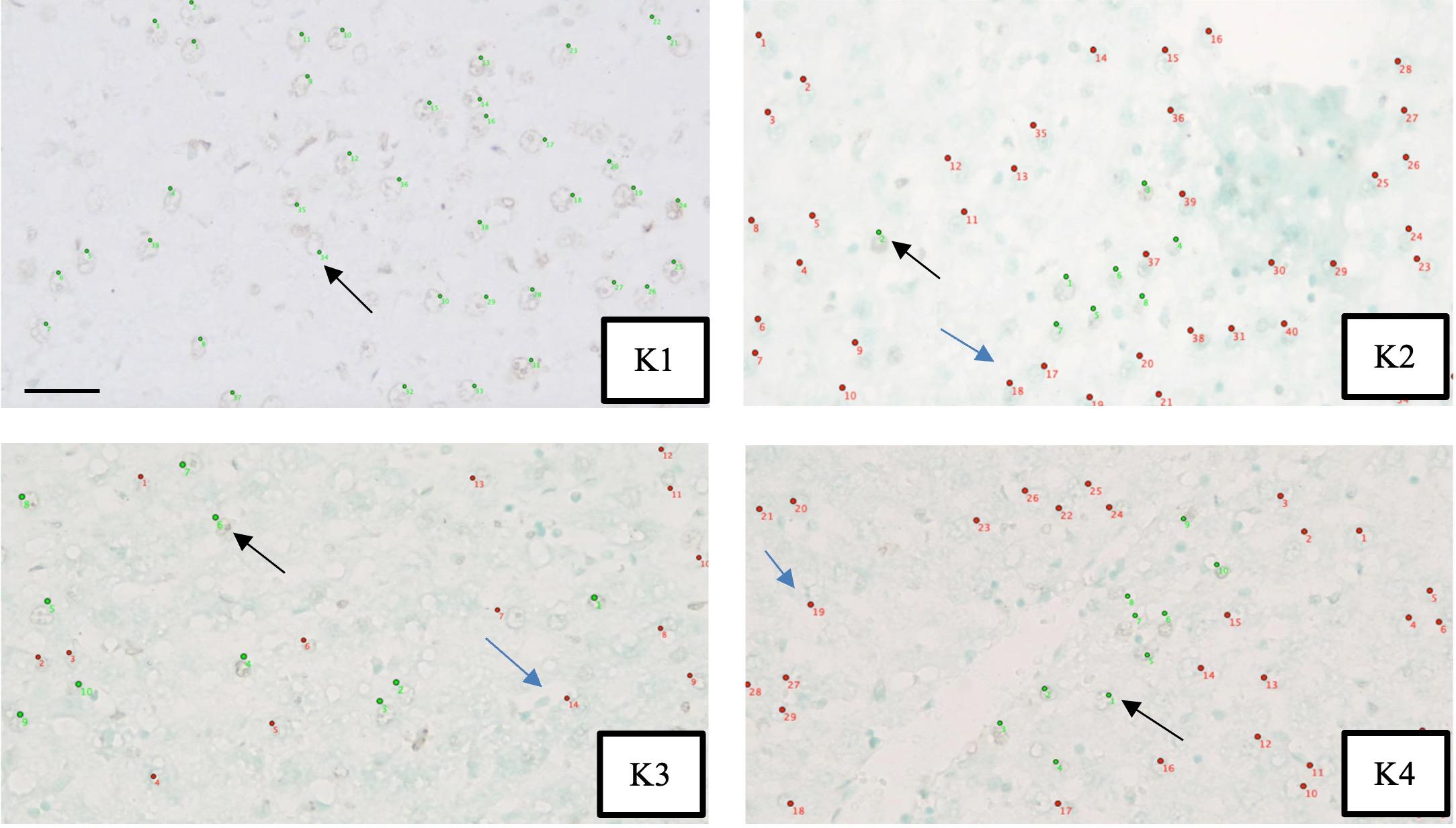 Human mesenchymal stem cell secretome lowers caspase-3 levels and apoptosis in hepatocytes of cholestatic rats