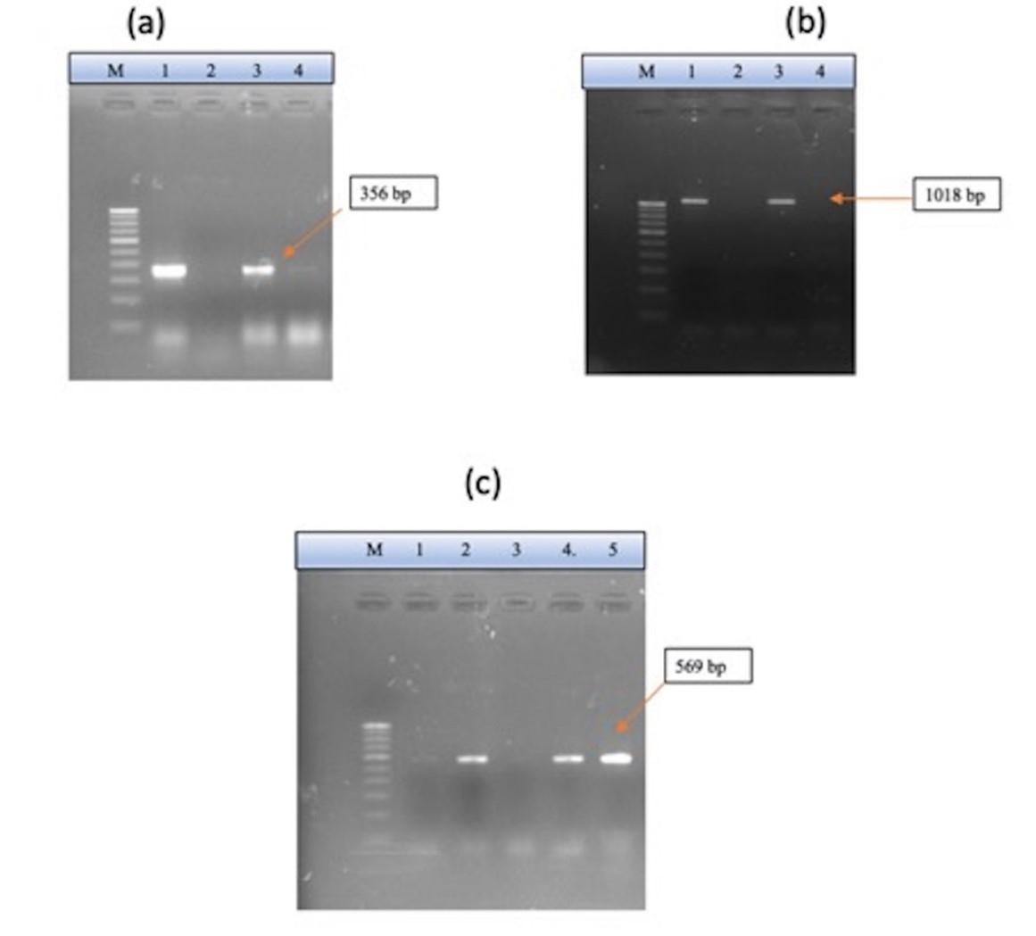 Characterization of virulence gene distribution and antibiotic susceptibility profiles of diarrheagenic Escherichia coli from chicken faeces
