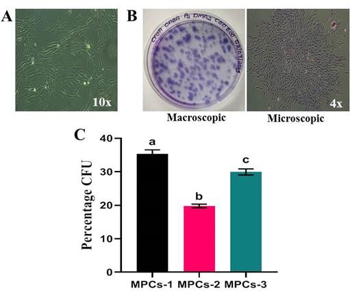 Characterization of human articular cartilage derived mesenchymal progenitor cells from osteoarthritis patients