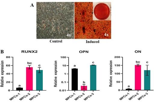 Characterization of human articular cartilage derived mesenchymal progenitor cells from osteoarthritis patients