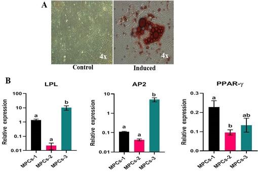 Characterization of human articular cartilage derived mesenchymal progenitor cells from osteoarthritis patients