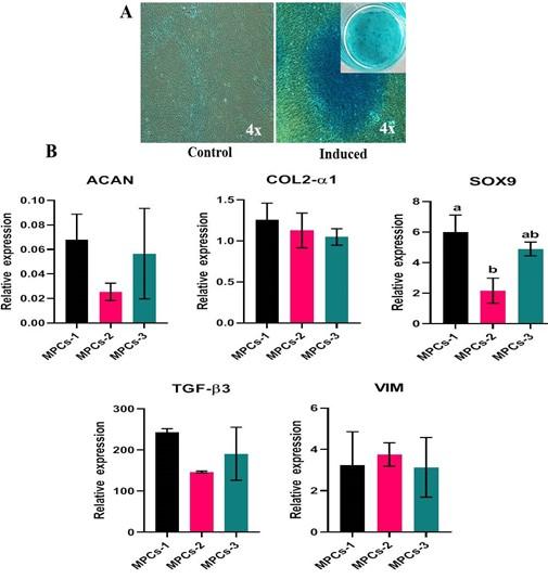 Characterization of human articular cartilage derived mesenchymal progenitor cells from osteoarthritis patients