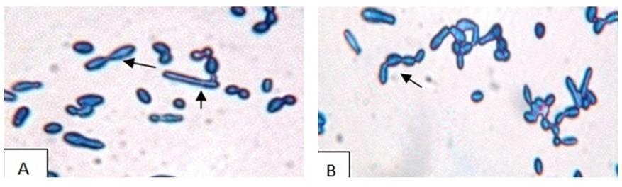 Isolation and characterization of osmophilic fermentative yeasts from Bangladeshi honeys