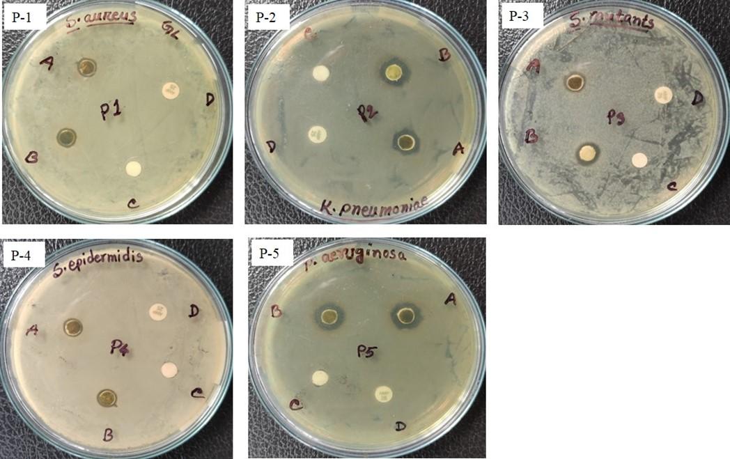 Antibacterial activity of silver nanoparticles synthesized from leaf and flower extracts of Galinsoga formosa