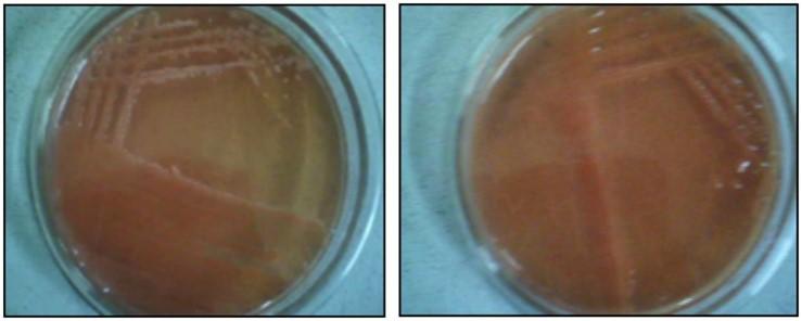 Presumptive correlation between phenotypic, genotypic and symbiotic diversities with antibiotic susceptibility traits of rhizobial strains from plant legumes