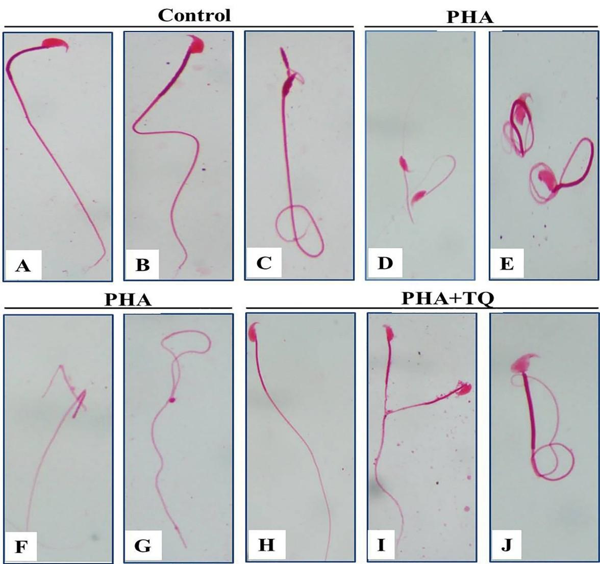 Thymoquinone mitigates phthalate-induced reproductive toxicities in male Swiss albino mice