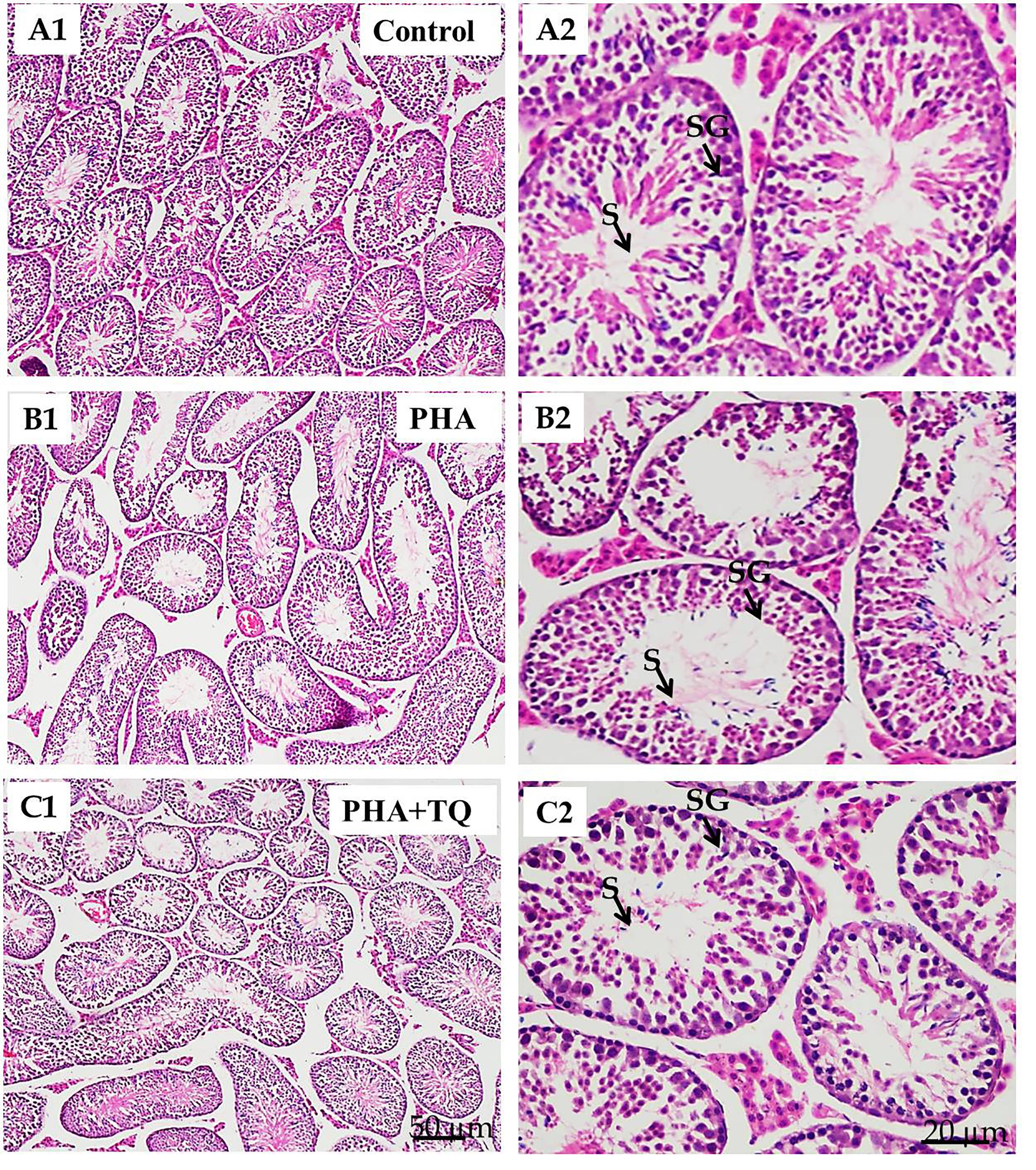 Thymoquinone mitigates phthalate-induced reproductive toxicities in male Swiss albino mice