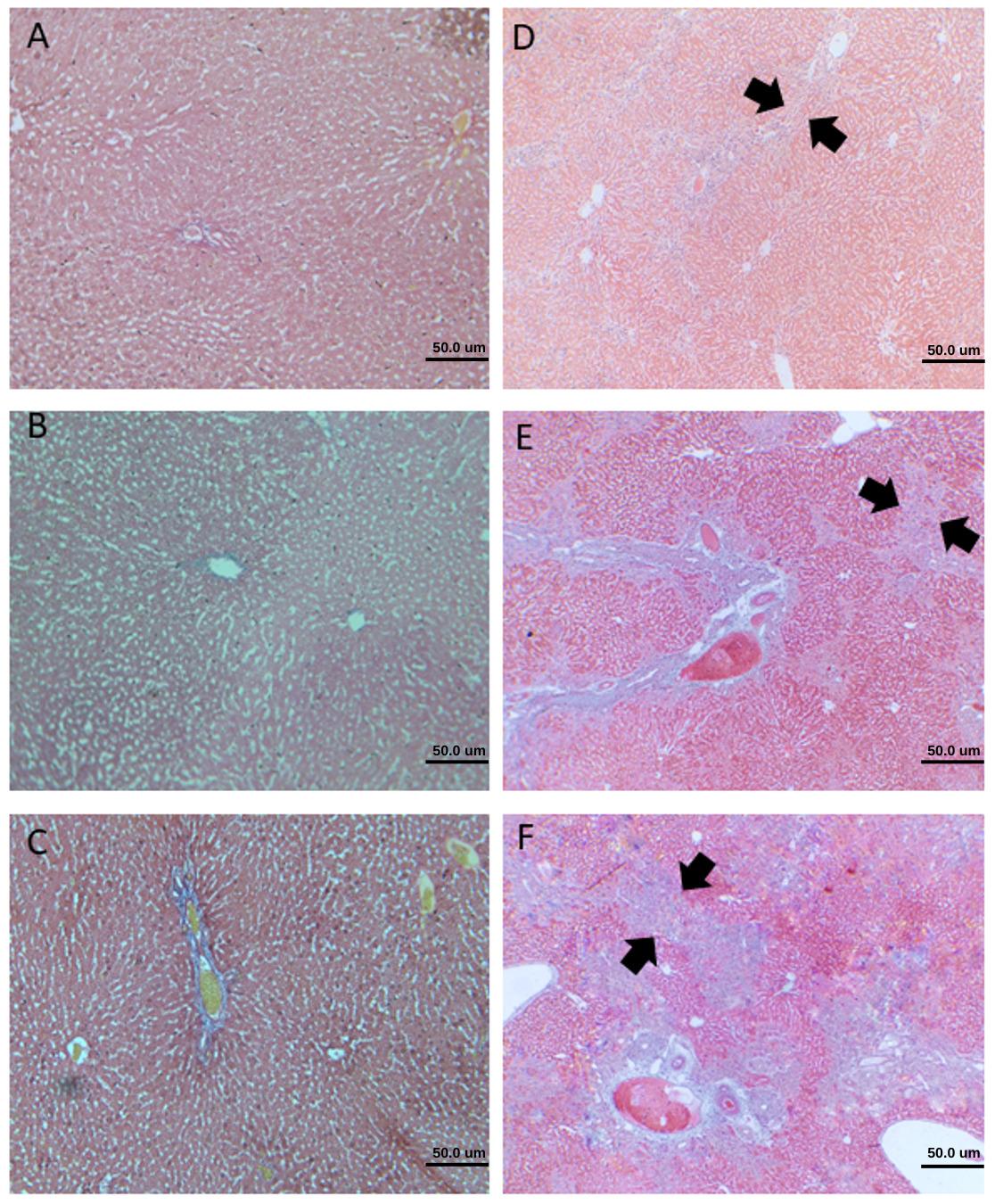A combination of ursodeoxycholic acid and <span>Allium sativum</span> prevents liver cirrhosis in cholestatic rats