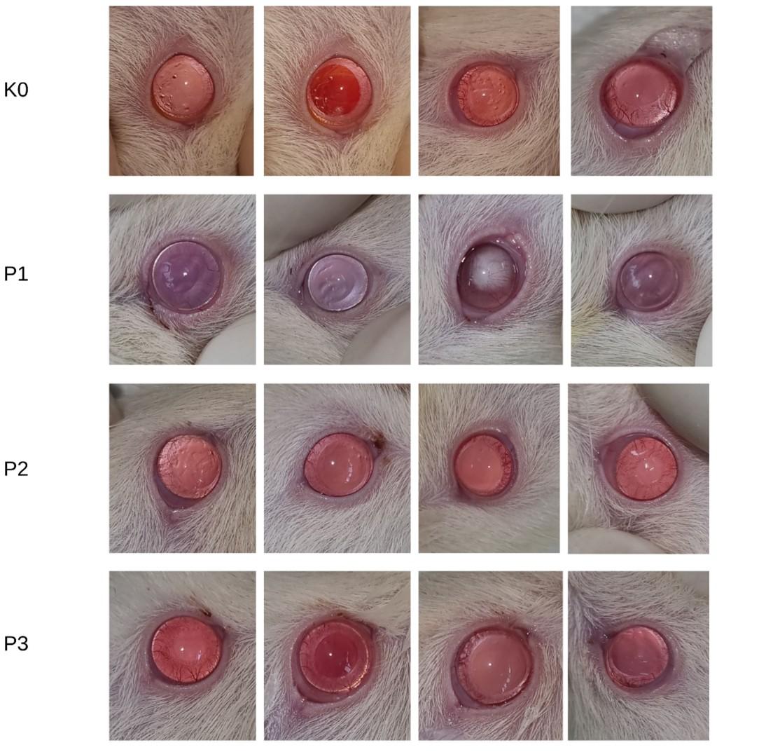Senofilcon A contact lenses and UV-blocking spectacle lenses provide equal protection against UV-induced expression of p53 and caspase-3 in lens epithelial cells