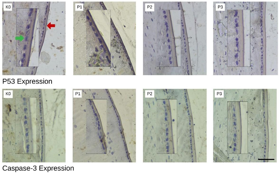 Senofilcon A contact lenses and UV-blocking spectacle lenses provide equal protection against UV-induced expression of p53 and caspase-3 in lens epithelial cells