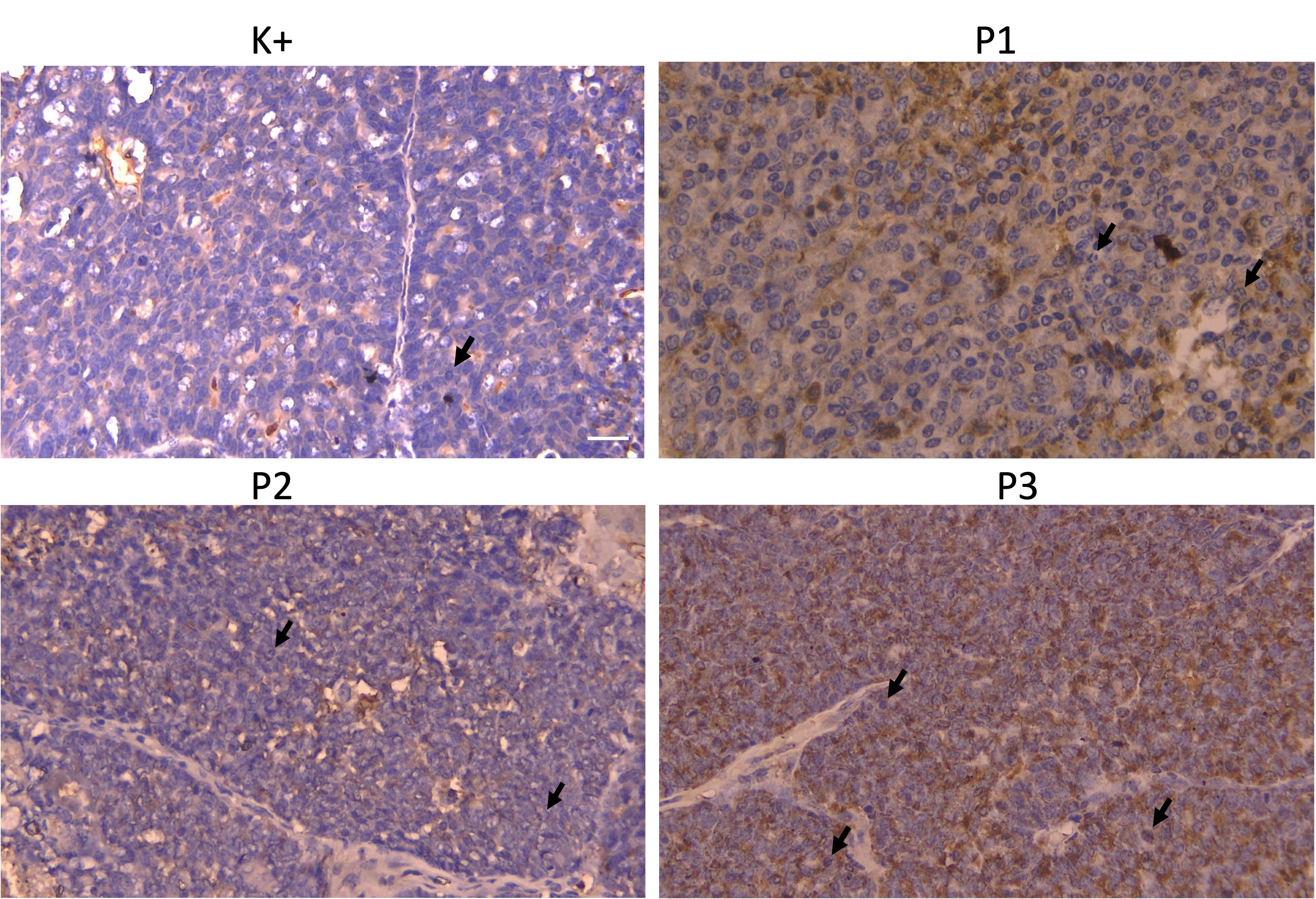 Effect of turmeric extract <span>(Curcuma longa)</span> on apoptosis in a rat model of mammary adenocarcinoma with adriamycin-cyclophosphamide chemotherapy