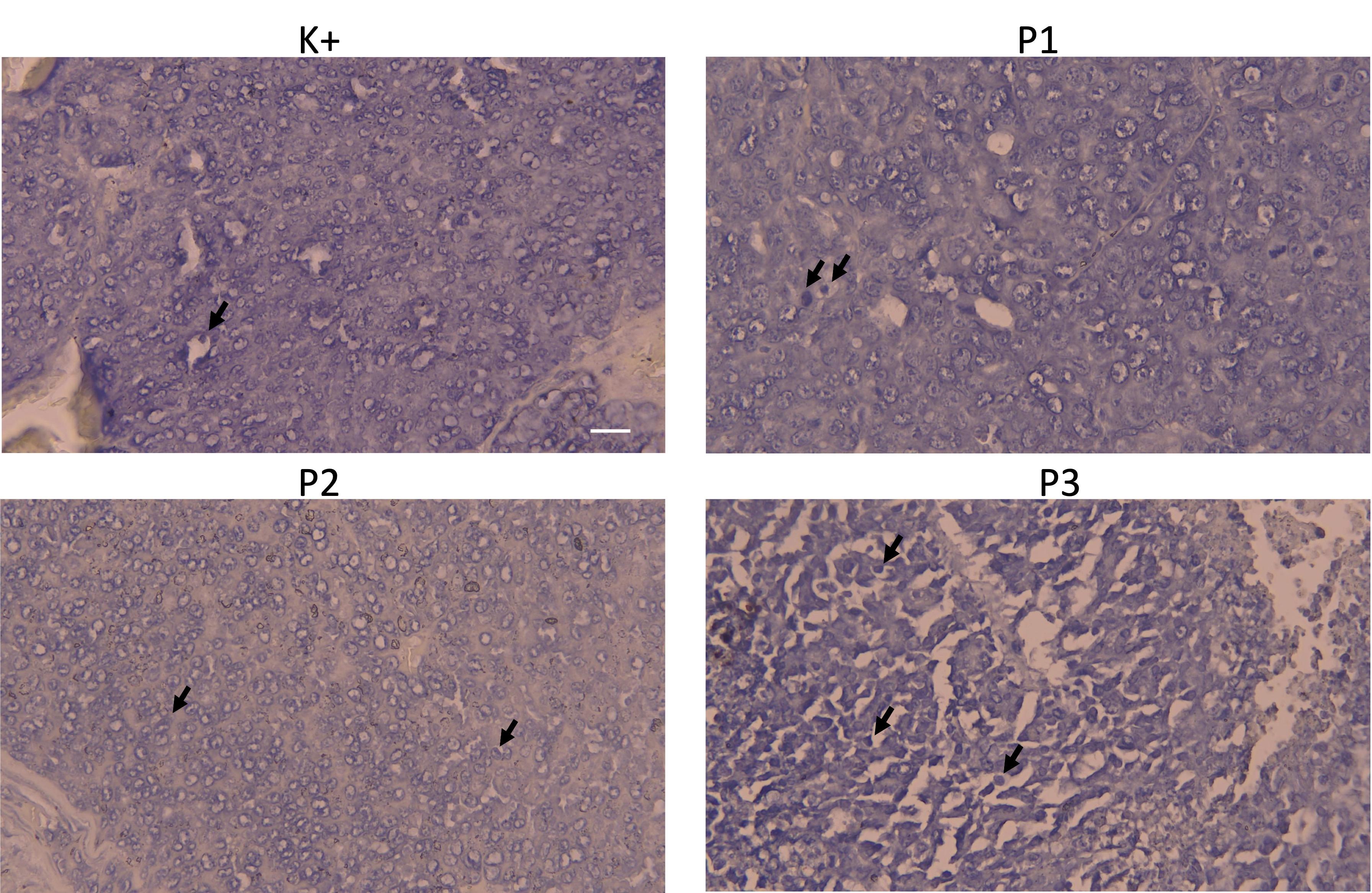 Effect of turmeric extract <span>(Curcuma longa)</span> on apoptosis in a rat model of mammary adenocarcinoma with adriamycin-cyclophosphamide chemotherapy