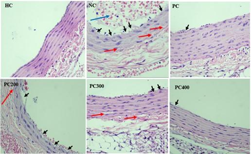 Effect of Piper crocatum leaves extract on atherosclerosis in diabetic rats