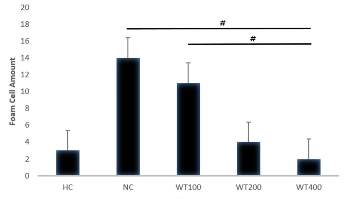 Effect of white tea (Camellia sinensis) leaf extract on cigarette smoke and high-fat diet-induced atherosclerosis in Wistar rats