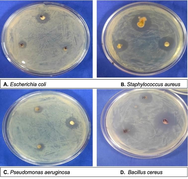 Optimization of surface sterilization method for the isolation of endophytic fungi associated with Curcuma longa L. and their antibacterial activity