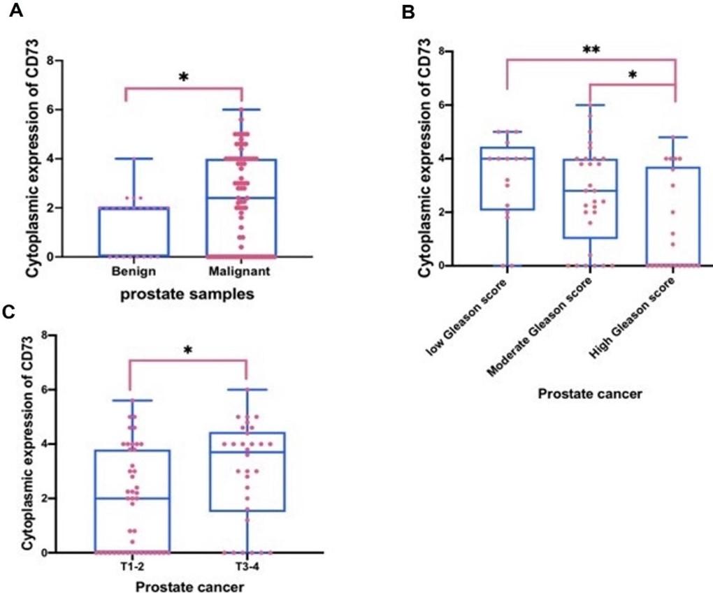 Increased CD73 expression is associated with poorly differentiated Gleason score and tumor size in prostate cancer