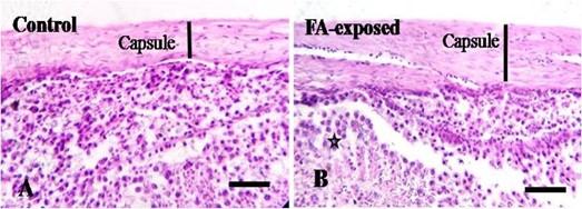 Formaldehyde-contaminated feed induces histopathological changes in the testes of adult pigeons (Columba livia)