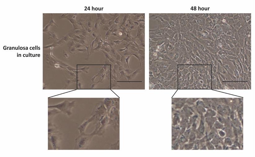 A reliable and easy method to isolate a pure population of bovine granulosa cells from slaughterhouse ovaries for in vitro studies