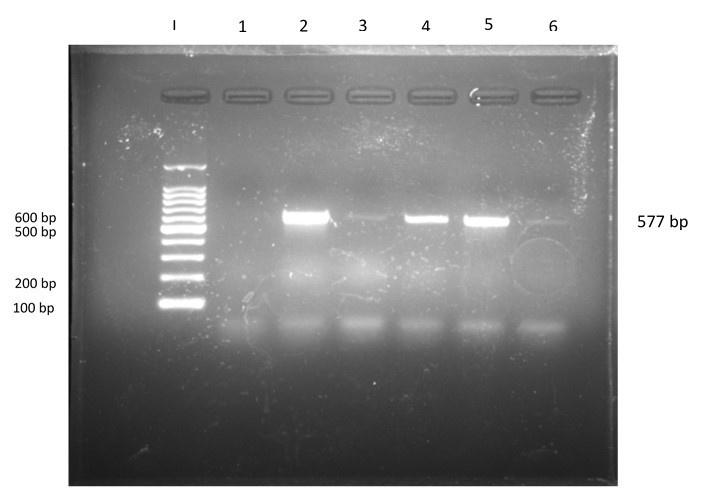 Characterization of <span>tetA</span> gene of <span>Escherichia coli</span>  isolated from colibacillosis affected calves in Rangpur, Bangladesh
