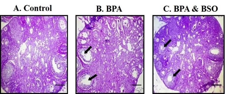 Ameliorating effects of black seed oil on bisphenol A-induced abnormality of blood, hormone profile and gonadal histology of female mice