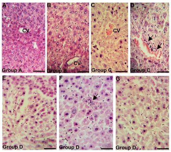 Long term administration of gentamicin affects hemato-biochemical parameters and liver architecture of Swiss Albino mice